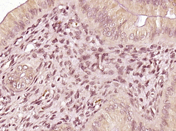 CDKN1A/P21 Rabbit Polyclonal Antibody