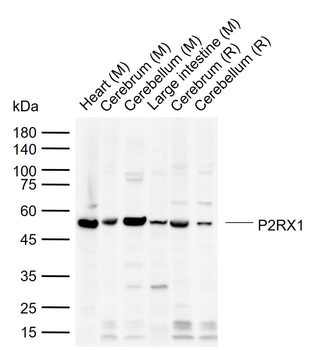 P2RX1 Rabbit Polyclonal Antibody
