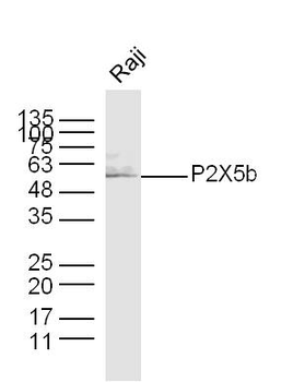 P2X5b Rabbit Polyclonal Antibody