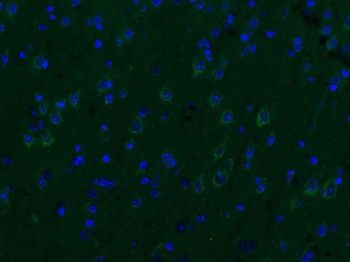P2Y9 Rabbit Polyclonal Antibody