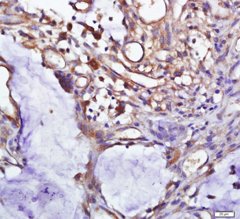 Pan Cytokeratin Rabbit Polyclonal Antibody