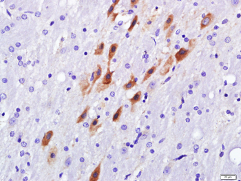 Pan Cytokeratin Rabbit Polyclonal Antibody