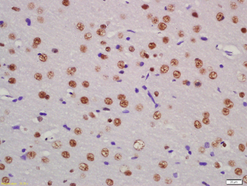 PASD5 Rabbit Polyclonal Antibody