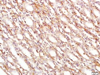 PCDH10 Rabbit Polyclonal Antibody
