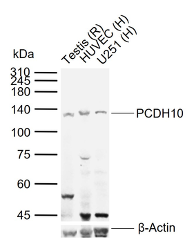 PCDH10 Rabbit Polyclonal Antibody