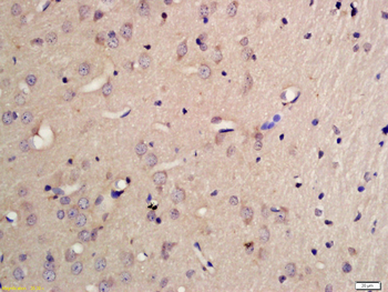 PCDHB10 Rabbit Polyclonal Antibody
