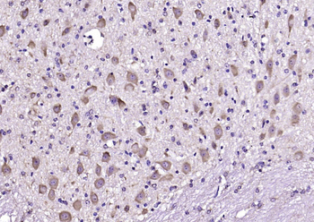 PCP4 Rabbit Polyclonal Antibody