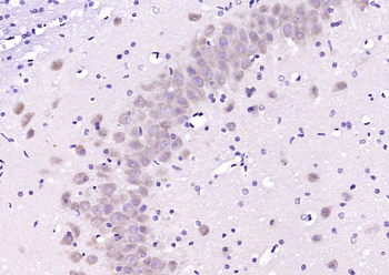 PCP4 Rabbit Polyclonal Antibody