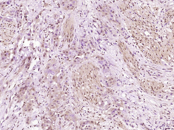 PCYT1A Rabbit Polyclonal Antibody