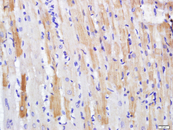 PDE7A Rabbit Polyclonal Antibody