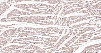PDE7A Rabbit Polyclonal Antibody