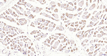 PDE7A Rabbit Polyclonal Antibody
