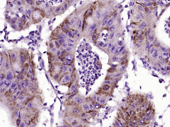 PDGFAA + PDGFBB Rabbit Polyclonal Antibody