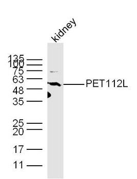PET112L Rabbit Polyclonal Antibody