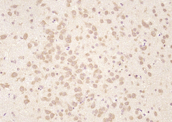 PICALM Rabbit Polyclonal Antibody