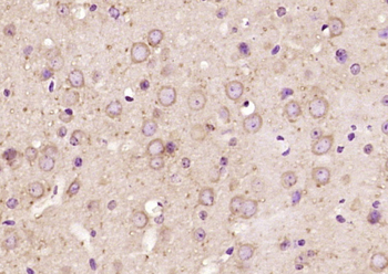 PIP5KL1 Rabbit Polyclonal Antibody