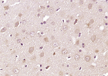 PIP5KL1 Rabbit Polyclonal Antibody