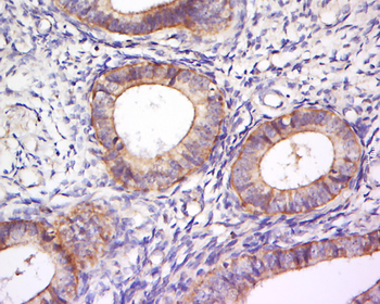 PLEKHA7 Rabbit Polyclonal Antibody