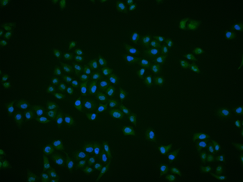 PPP1R10 Rabbit Polyclonal Antibody