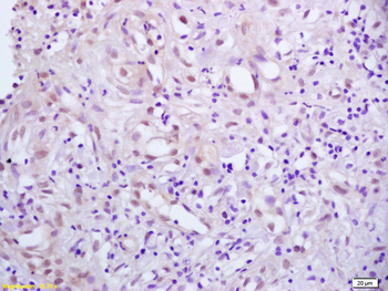 Phospho-PPAR Gamma (ser273) Rabbit Polyclonal Antibody