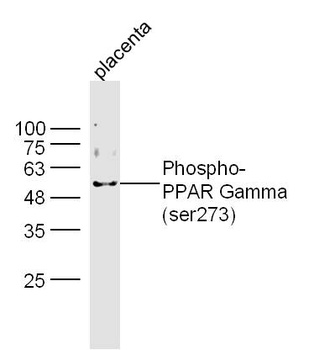 PPAR Gamma (Phospho-ser273) antibody