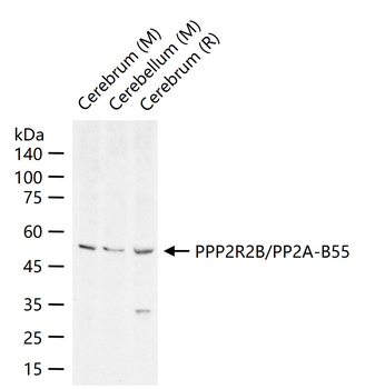 PPP2R2B/PP2A-B55 Rabbit Polyclonal Antibody