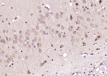 Prickle Rabbit Polyclonal Antibody