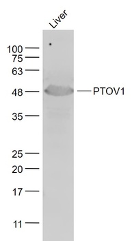 PTOV1 antibody