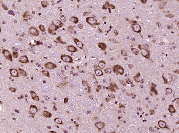 STEP Rabbit Polyclonal Antibody