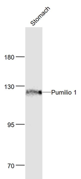 Pumilio 1 Rabbit Polyclonal Antibody