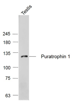Puratrophin 1 Rabbit Polyclonal Antibody