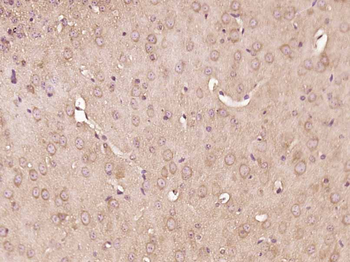 RAB10 Rabbit Polyclonal Antibody