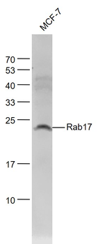 Rab17 Rabbit Polyclonal Antibody