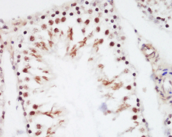 RBMY1F Rabbit Polyclonal Antibody