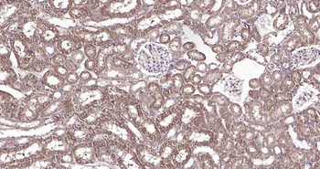 RILPL2 Rabbit Polyclonal Antibody