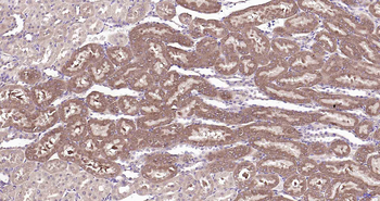 RILPL2 Rabbit Polyclonal Antibody