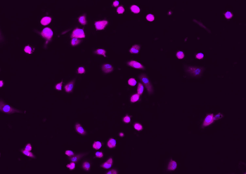 CDKN1A/P21 Rabbit Polyclonal Antibody (BF647)