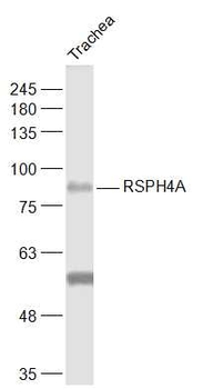 RSPH4A Rabbit Polyclonal Antibody