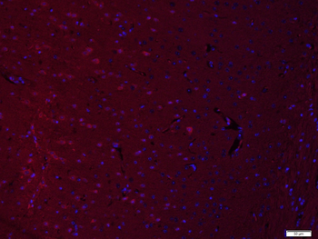 EIF2S1 Rabbit Polyclonal Antibody (BF594)