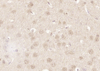 SAP155 Rabbit Polyclonal Antibody