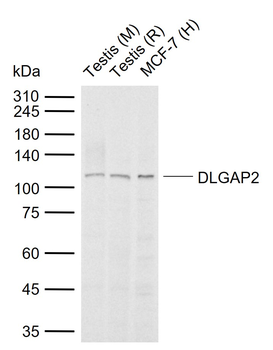 DLGAP2 Rabbit Polyclonal Antibody