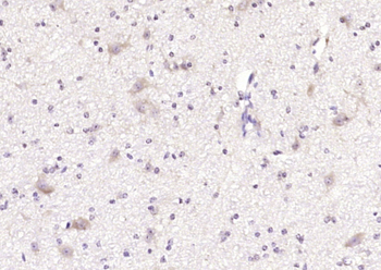 AFG3L2 Rabbit Polyclonal Antibody
