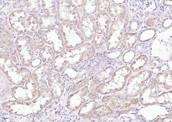 Sclerostin Rabbit Polyclonal Antibody