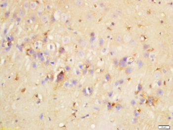 SCNN1D Rabbit Polyclonal Antibody