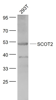 SCOT2 Rabbit Polyclonal Antibody