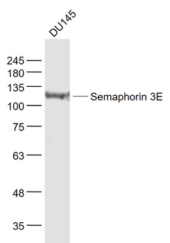 Semaphorin 3E Rabbit Polyclonal Antibody