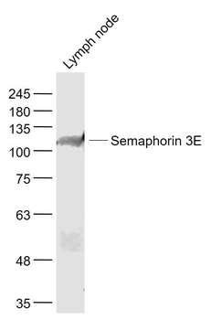 Semaphorin 3E Rabbit Polyclonal Antibody