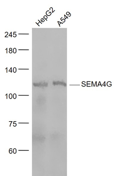 SEMA4G Rabbit Polyclonal Antibody