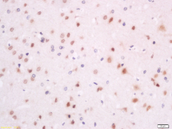 SRSF7 Rabbit Polyclonal Antibody