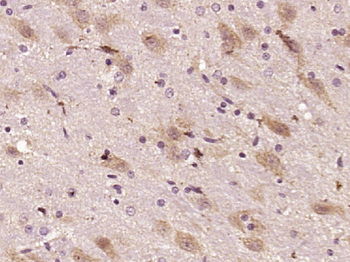 KIAA1598 Rabbit Polyclonal Antibody